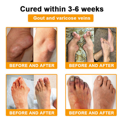 Official Only Store🇬🇧Healrize®🔥 BEE VENOM LITHOSPERMUM Pain-Relief Bone Healing Cream 👑👑(Specially for older adults)