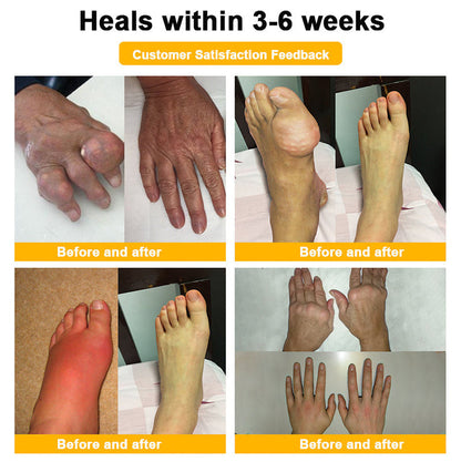 Official Only Store🇬🇧Healrize®🔥 BEE VENOM LITHOSPERMUM Pain-Relief Bone Healing Cream 👑👑(Specially for older adults)