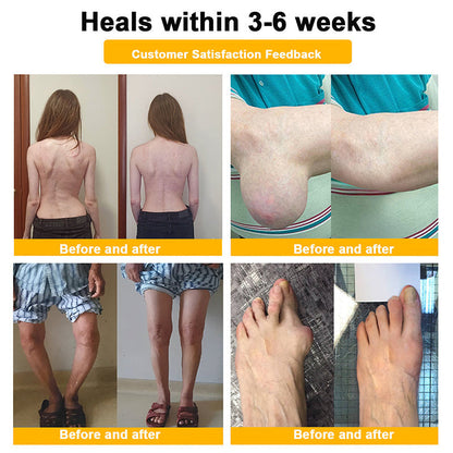 Official Only Store🇬🇧Healrize®🔥 BEE VENOM LITHOSPERMUM Pain-Relief Bone Healing Cream 👑👑(Specially for older adults)