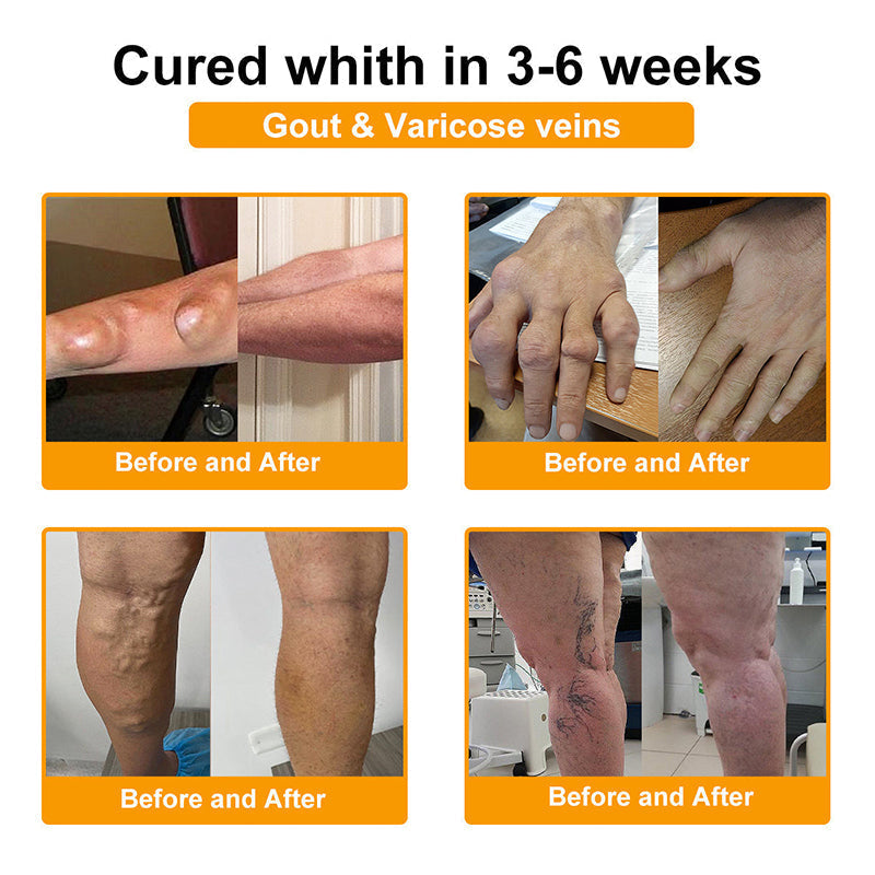 Official Only Store🇬🇧Healrize®🔥 BEE VENOM LITHOSPERMUM Pain-Relief Bone Healing Cream 👑👑(Specially for older adults)